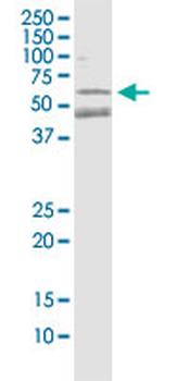 PARK2 monoclonal antibody (M01), clone 1H4