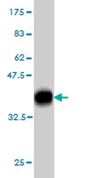 PARK2 monoclonal antibody (M01), clone 1H4