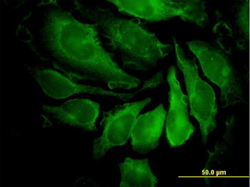 PAK1 monoclonal antibody (M02), clone 4D1