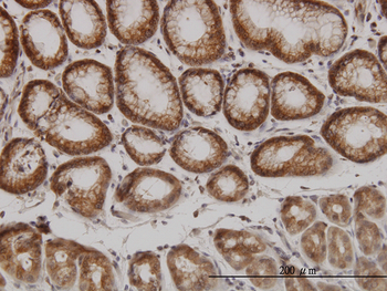 PAK1 monoclonal antibody (M02), clone 4D1