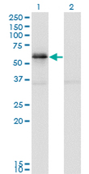 PAK1 monoclonal antibody (M02), clone 4D1