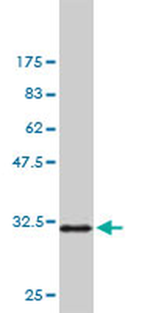 PAK1 monoclonal antibody (M02), clone 4D1