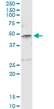 SERPINE1 monoclonal antibody (M01), clone 3F2