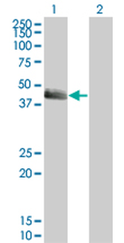 SERPINE1 monoclonal antibody (M01), clone 3F2