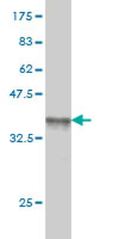 SERPINE1 monoclonal antibody (M01), clone 3F2