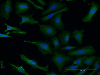 PAFAH1B1 monoclonal antibody (M03), clone 5A5