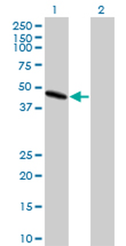 PAFAH1B1 monoclonal antibody (M03), clone 5A5