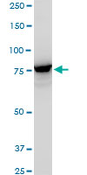 PCSK6 polyclonal antibody (A01)
