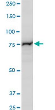 PCSK6 polyclonal antibody (A01)