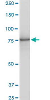 PCSK6 polyclonal antibody (A01)