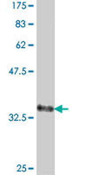 PCSK6 polyclonal antibody (A01)