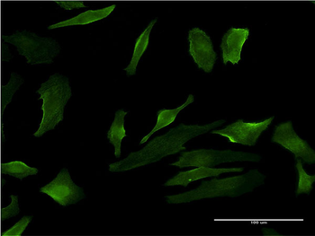 P2RY1 monoclonal antibody (M01), clone 4C2