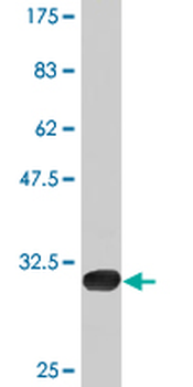 P2RY1 monoclonal antibody (M01), clone 4C2