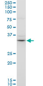 OTX1 polyclonal antibody (A01)