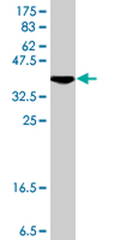 OTX1 polyclonal antibody (A01)