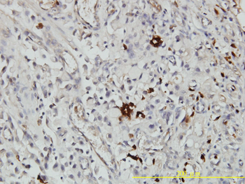 ORM1 monoclonal antibody (M01), clone 2F9-1F10