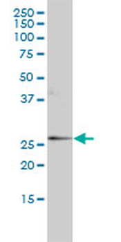 ORM1 monoclonal antibody (M01), clone 2F9-1F10