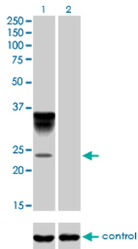 ORM1 monoclonal antibody (M01), clone 2F9-1F10