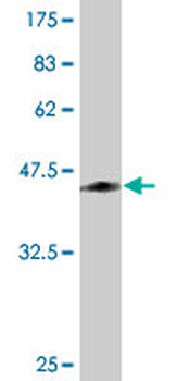 ORM1 monoclonal antibody (M01), clone 2F9-1F10