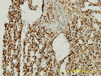 ORC2L monoclonal antibody (M01), clone 3E11-1G5