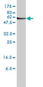 ORC2L monoclonal antibody (M01), clone 3E11-1G5