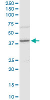 OPRK1 polyclonal antibody (A01)