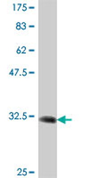 OPRK1 polyclonal antibody (A01)