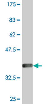 ODF2 monoclonal antibody (M01), clone 1A1