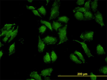 OCLN monoclonal antibody (M01), clone 1G7