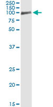OCLN monoclonal antibody (M01), clone 1G7