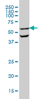 OCLN monoclonal antibody (M01), clone 1G7