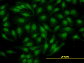 NR4A2 monoclonal antibody (M07), clone 4A6