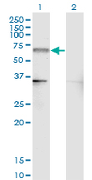 NR4A2 monoclonal antibody (M07), clone 4A6