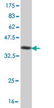 NR4A2 monoclonal antibody (M07), clone 4A6