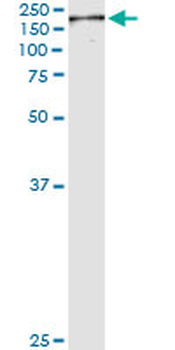 NUMA1 monoclonal antibody (M01), clone 1C5