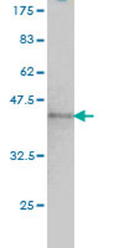 NUMA1 monoclonal antibody (M01), clone 1C5