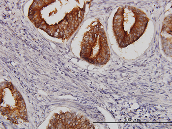 SLC11A2 monoclonal antibody (M01), clone 4C6