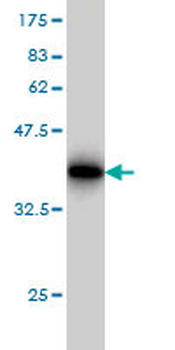 SLC11A2 monoclonal antibody (M01), clone 4C6
