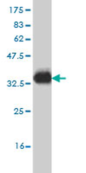 NPY1R monoclonal antibody (M03), clone 2G2