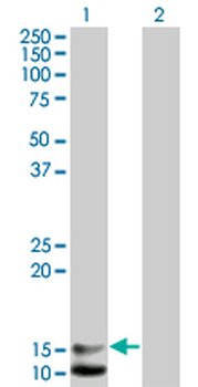 NPPB monoclonal antibody (M01), clone 2D11