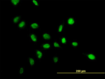NPM1 monoclonal antibody (M01), clone 3B2