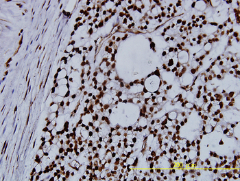 NPM1 monoclonal antibody (M01), clone 3B2