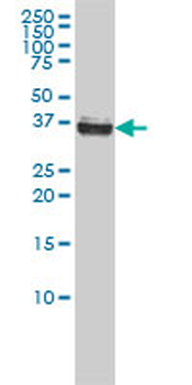 NPM1 monoclonal antibody (M01), clone 3B2