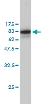 NPM1 monoclonal antibody (M01), clone 3B2