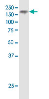 NPC1 monoclonal antibody (M02), clone 4H2