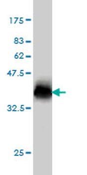 NPC1 monoclonal antibody (M02), clone 4H2