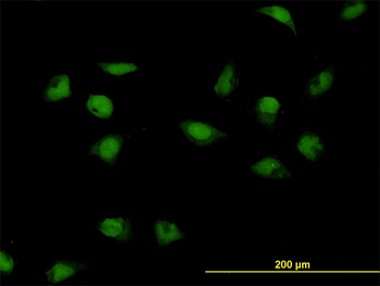 CNOT3 monoclonal antibody (M01), clone 4B8