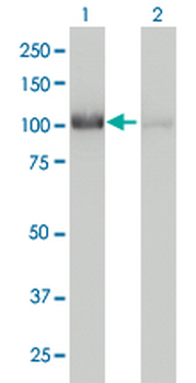 CNOT3 monoclonal antibody (M01), clone 4B8