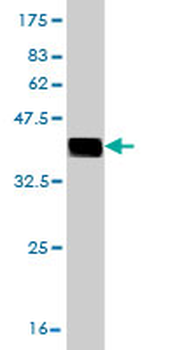 CNOT3 monoclonal antibody (M01), clone 4B8