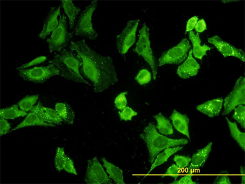 NODAL monoclonal antibody (M03), clone 5C3